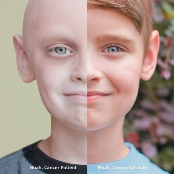 cool pic kid who beat cancer - Noah, Cancer Patient Noah, Cancer Survivor