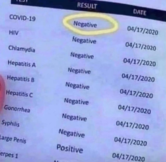 Coronavirus disease 2019 - Result Date Covid19 Negative 04172020 Hiv Negative 04172020 Chlamydia Negative Hepatitis A 04172020 Negative Hepatitis B 04172020 Negative Hepatitis C 04172020 Negative Gonorrhea 04172020 Negative Syphilis 04172020 Negative Larg