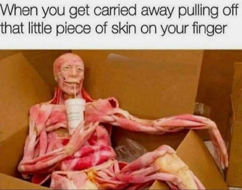 Humour - When you get carried away pulling off that little piece of skin on your finger