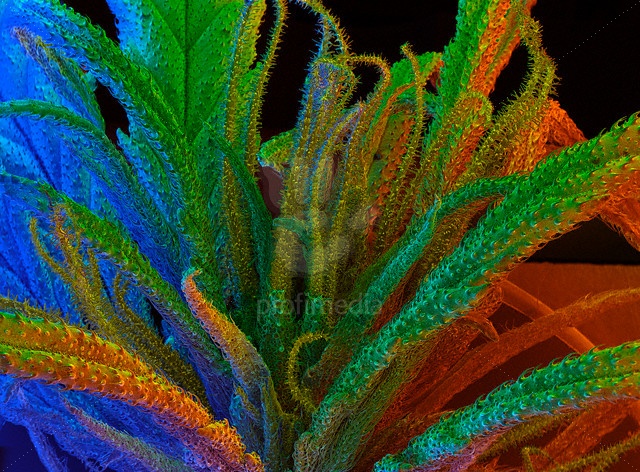 A falsely colored electron micrograph.