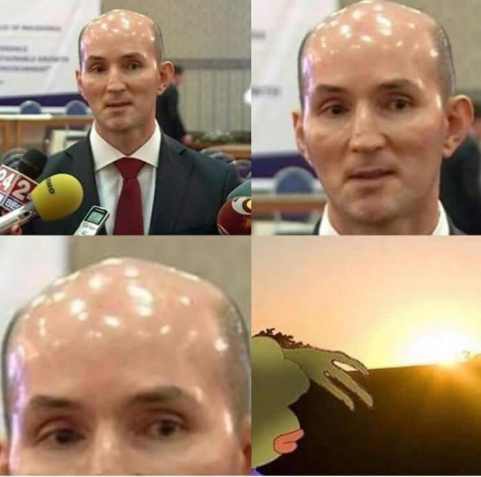 shiney forehead meme