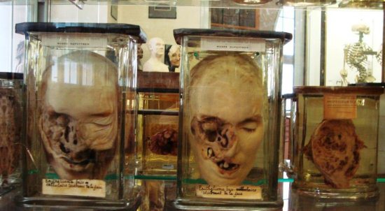 Musee Dupuytren, Paris, FranceAnother hall of medical oddities that will probably separate you from your lunch.