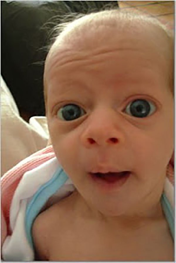 Babies That Look Suspiciously Like Old People