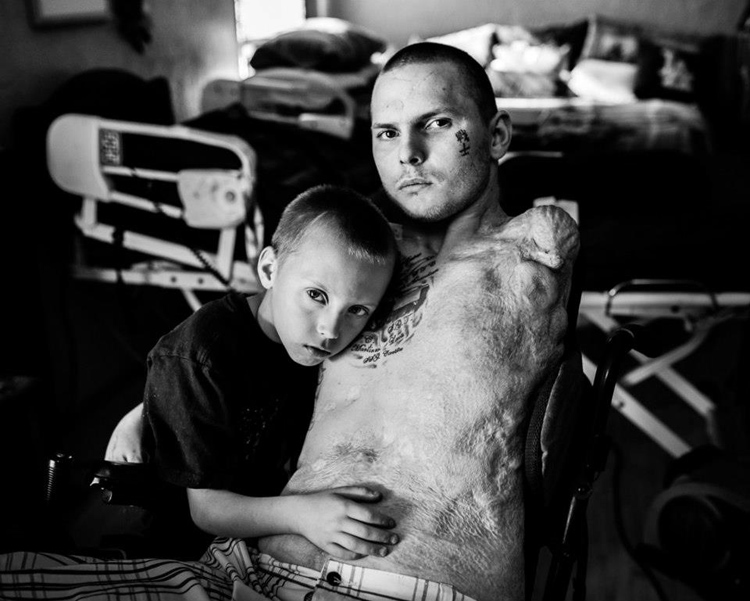 Whilst driving a M1 Abrams tank, Jerral Handcock was stuck by a roadside bomb. He lost one arm to the flames and was paralyzed from the waist down when shrapnel severed his spinal cord. He is pictured here holding one of his two children.
