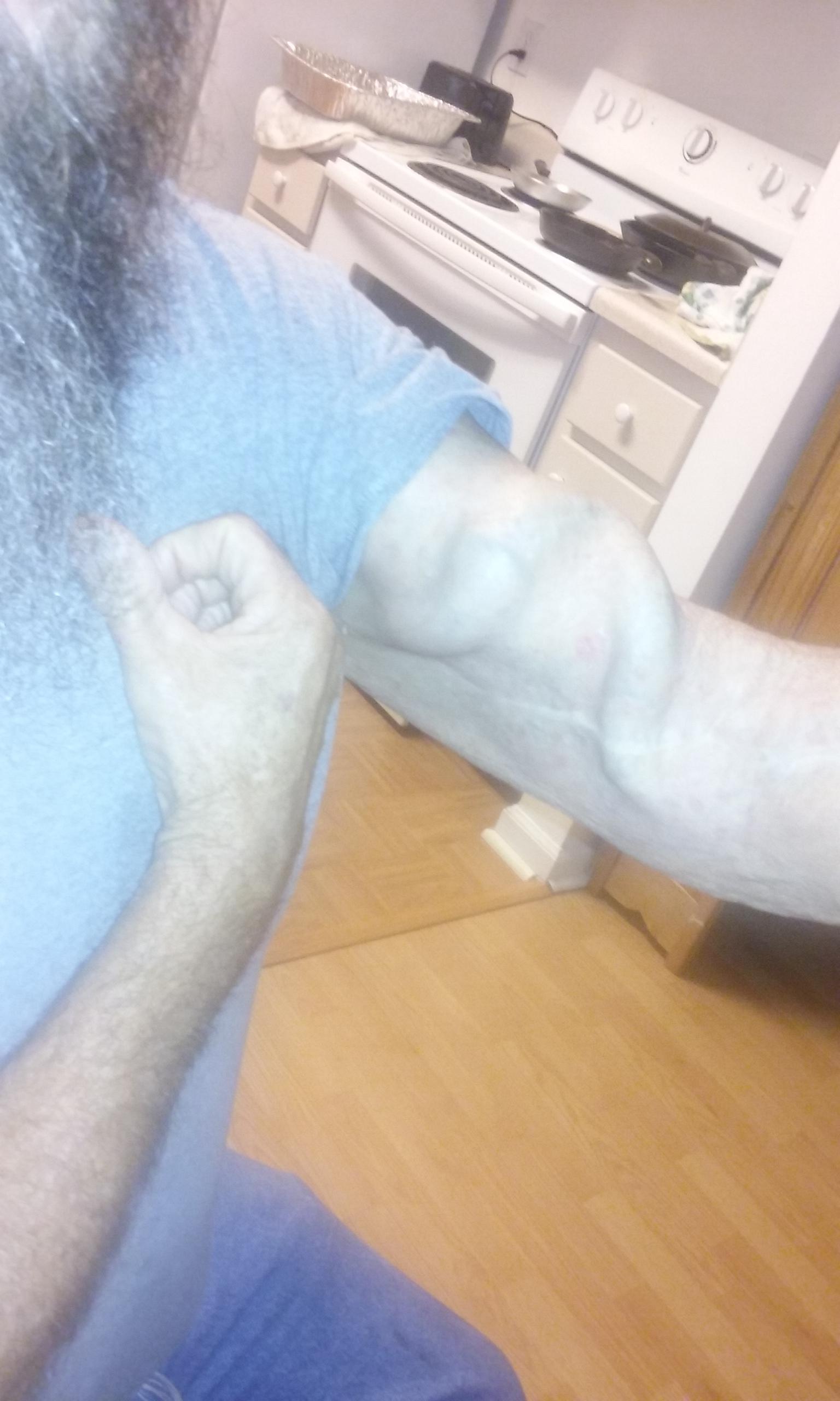 A vein in my girlfriend's dad's arm.