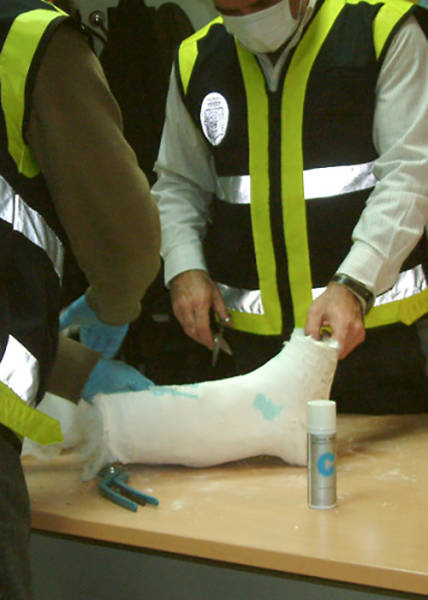 Spanish Police cut a cast made of cocaine that was worn by a 66-year-old Chilean man who tried to smuggle the drugs into Barcelona airport in 2009
