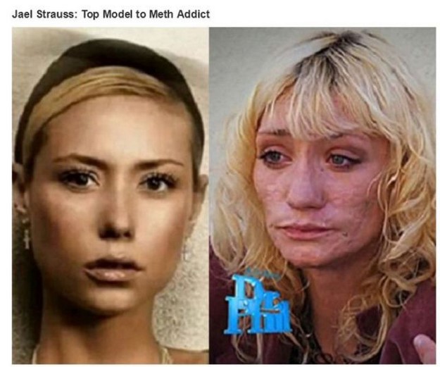 meth addict - Jael Strauss Top Model to Meth Addict