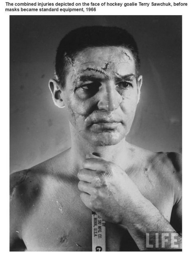 terry sawchuk - The combined injuries depicted on the face of hockey goalie Terry Sawchuk, before masks became standard equipment, 1966 Ebt Minn, Usa 3 Ski Mfg. Cog