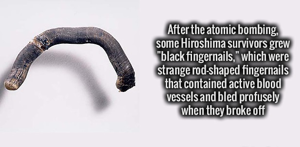 After the atomic bombing, some Hiroshima survivors grew "black fingernails," which were strange rodshaped fingernails that contained active blood vessels and bled profusely when they broke off