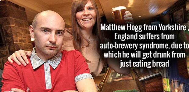 photo caption - Matthew Hogg from Yorkshire, England suffers from autobrewery syndrome, due to which he will get drunk from just eating bread