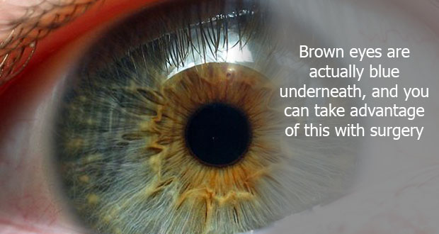 fact iris of the eye - Brown eyes are actually blue underneath, and you can take advantage of this with surgery