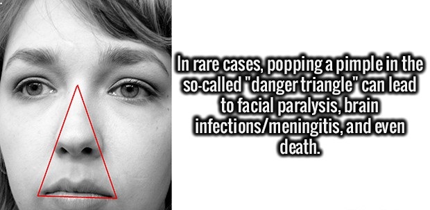 todays interesting facts - In rare cases, popping a pimple in the Socalled "danger triangle" can lead to facial paralysis, brain infectionsmeningitis, and even death.