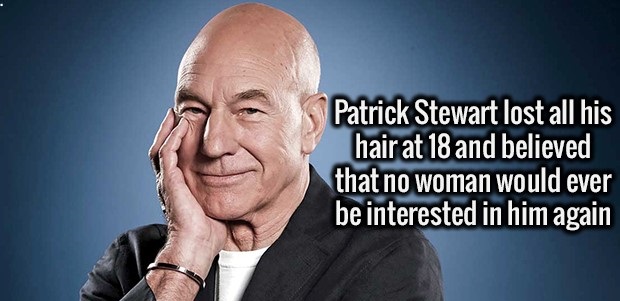 patrick stewart charles xavier - Patrick Stewart lost all his hair at 18 and believed that no woman would ever be interested in him again