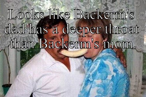 Backerm sucks