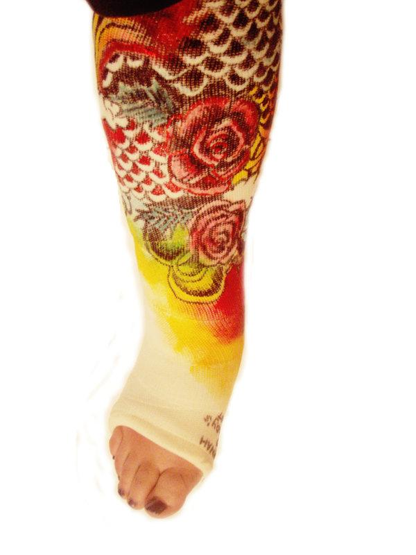 Arm And Leg Cast Artwork