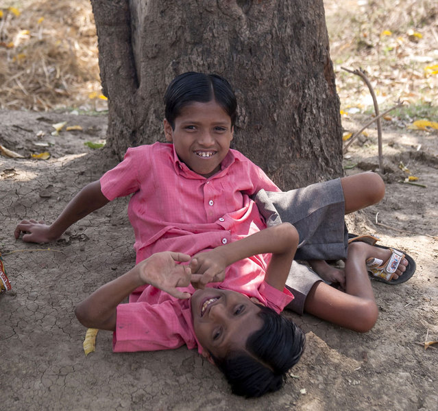 Conjoined Twins Who Are Worshipped In India
