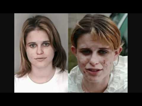 The horrific effects of drugs!!!