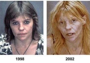 The horrific effects of drugs!!!