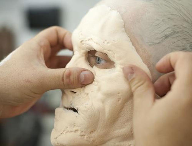 A custom-made, foam latex prosthesis extends from Galbraiths forehead to his neck.