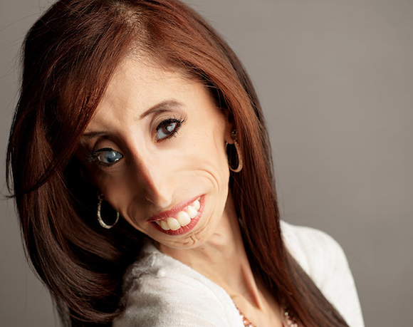Lizzie Velazquez of Austin, Texas is one of three people in the world with a rare condition that doesn't allow her to gain weight. As a result, she eats every 15 minutes just to stay alive.