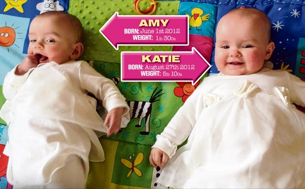 In 2013, twins Amy and Katie Elliot were born 87 days apart due to complications during the pregnancy. Little Amy was born 23 weeks into the pregnancy at only 1lb and 3oz. 87 days later, Katie was ready to join the family at 5lb and 10oz. They are both healthy!