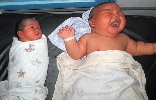 A woman in Russia suffering from Gestational Diabetes gave birth to a 19.2 pound baby! The condition can cause a baby to grow too large... As obviously shown by the picture. These babies are exactly the same age. OUCH.