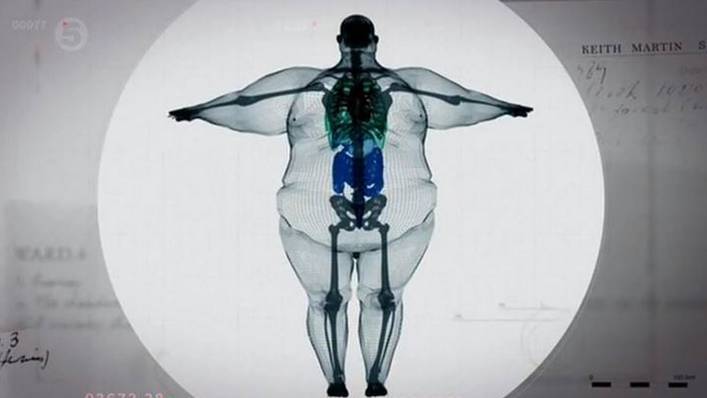 An x-ray of a 900 pound person.