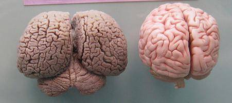 Comparing a dolphin brain and a human brain. The human brain is on the right.