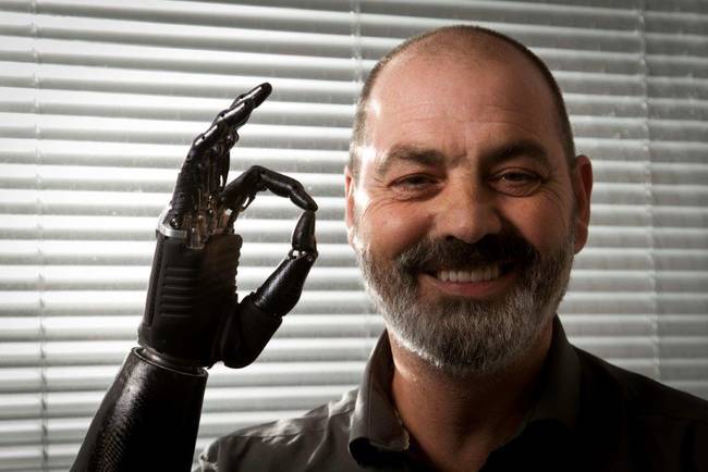 Nigel Ackland sports the most advanced cyborg arm on the planet. He can control each finger just like on a normal hand, and can even perfectly pour a glass of water.