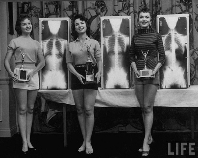 Winners of the 1956 Miss Perfect Posture contest at a chiropractors' convention.
