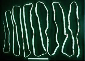 Tapeworm Cestoda. They can go up to 15 feet in a few months. In your intestines, I mean.