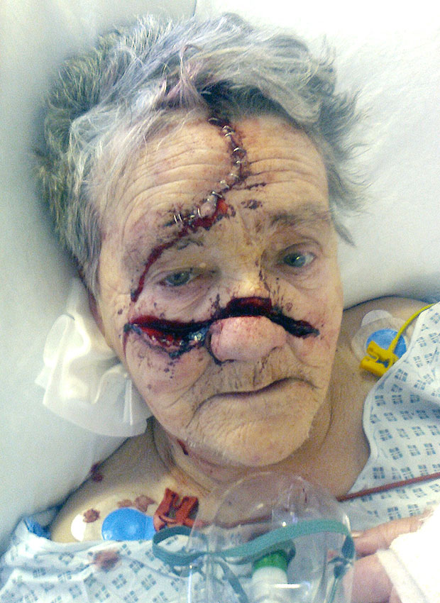 A then 76 year old grandmother, Mary Coulter, of Wishaw, North Lanarkshire UK, was attacked in her own home by two guy's. One had a machete and hit her repeatedly. One of the guys name is Darryl Finnie, 27 years old, and he is in jail. As far as I can tell, the other guy is still missing.