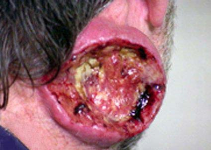 This is a neck. Actually, an infected neck. That is all I know