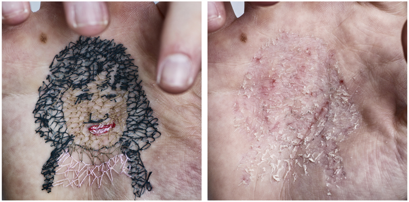 Man Sews the Faces of Loved Ones into the Palm of His Hand