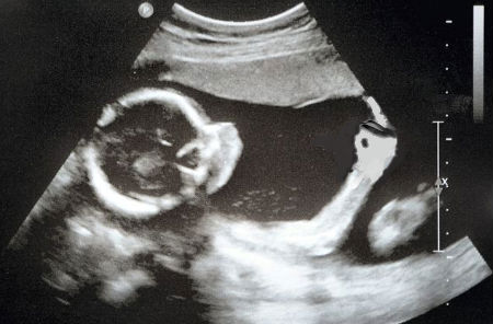 How I Miss Being A Kid