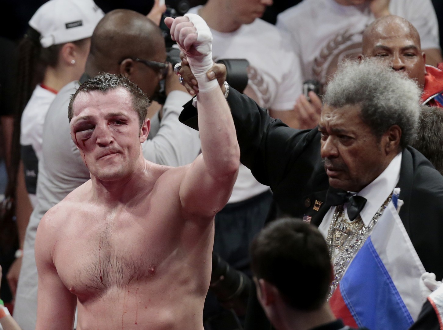 Demolished face of Russian boxer, Denis Lebedev