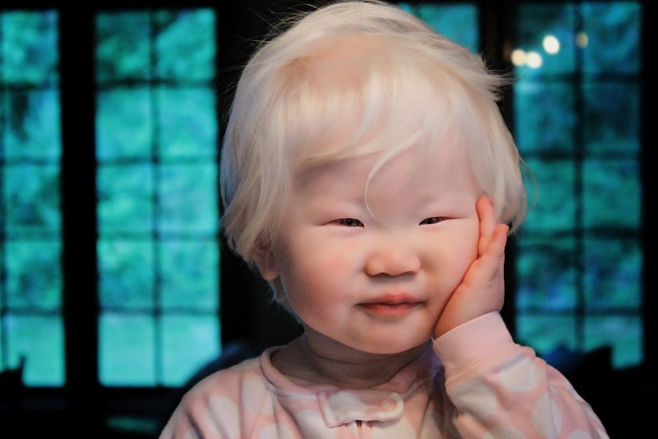 Albino kid from China
