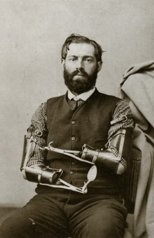 Civil War veteran Samuel Decker built his own prosthetics after losing his arms in combat. Date unknown