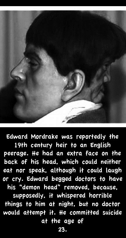 edward mordrake - Edward Mordrake was reportedly the 19th century heir to an English peerage. He had an extra face on the back of his head, which could neither eat nor speak, although it could laugh or cry. Edward begged doctors to have his demon head" re
