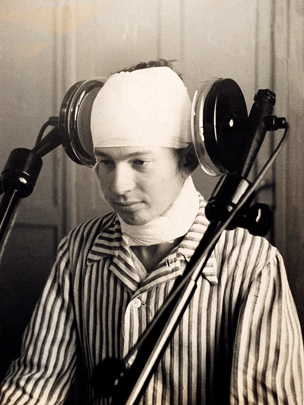 A patient undergoing lateral cerebral diathermia treatment in the early 1920's. Diathermia used a galvanized current to jolt psychosis sufferers. Doctors eventually deemed it unsafe and unreliable.
