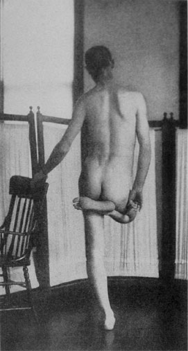 A chronic schizophrenic patient stands in a catatonic position. He maintained this uncomfortable position for hours