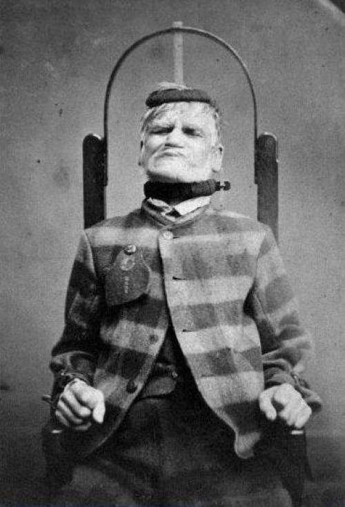 Patient in restraint chair at the West Riding Lunatic Asylum, Wakefield, Yorkshire ca. 1869
