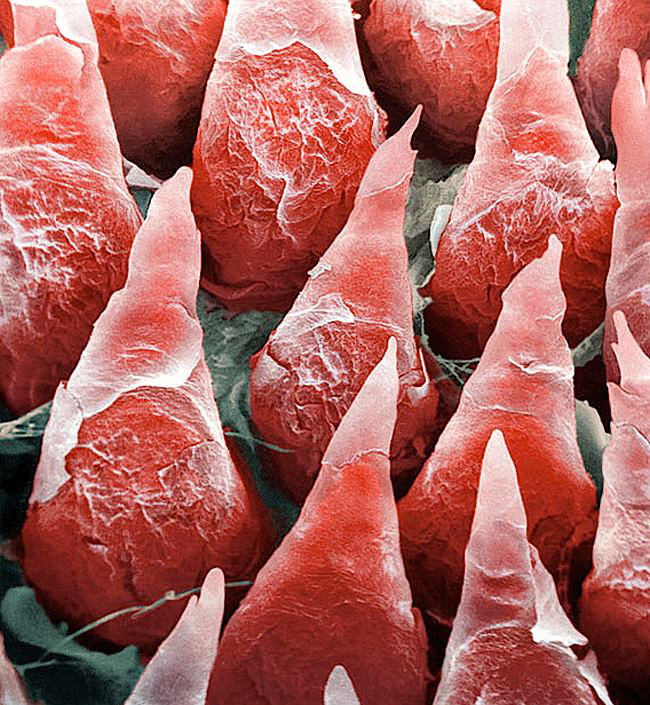 This is the microscopic image of the human tongue