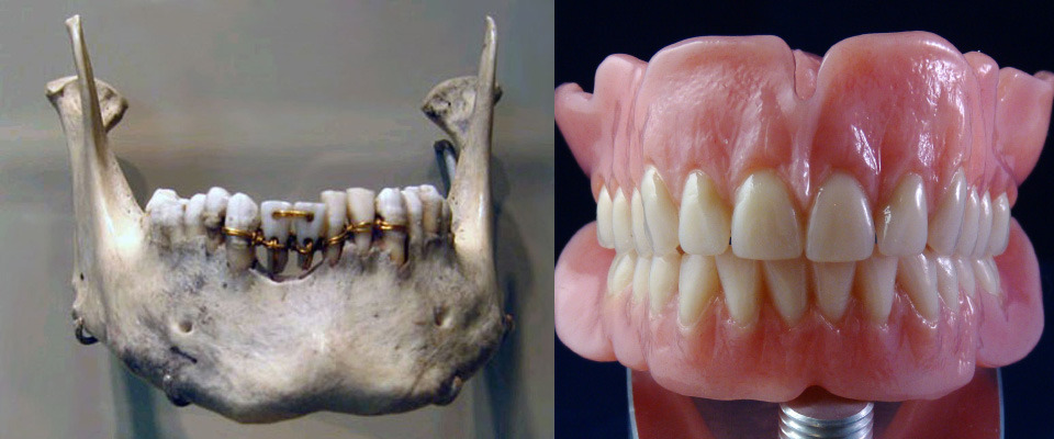 Left- Dentistry in Ancient Egypt. Right- Modern dentures