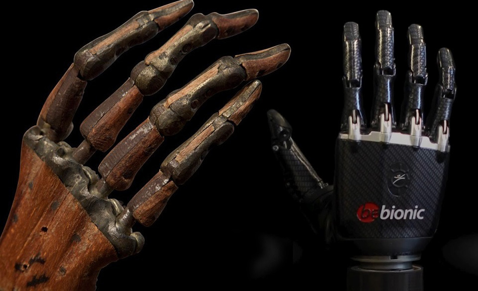 Left- Wooden prosthetic hand, c. 1800. Right- The bebionic B3 prosthetic hand receives signals from muscle twitches in your upper arm. These inputs can perform a range of motions that let you do things like hold a mouse, shake hands and write your name.