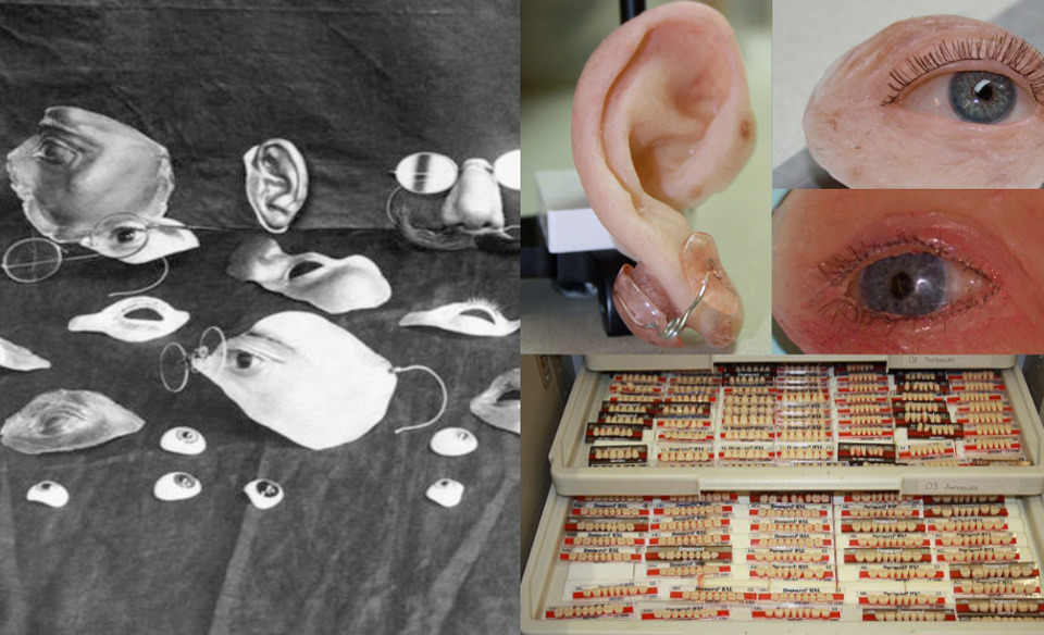 Left- Selection of some items used to disguise facial injuries. Early plastic surgery. Right- Ultra-realistic prosthetics. Doctors sculpt each feature in wax and mould into latex noses, teeth or ears.