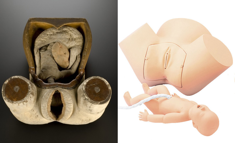 Left- Obstetric phantom, Italy 1700-1800. Tool to teach medical students and midwives about childbirth. Right- Obstetric phantom, USA 2010-2014. Tool to teach medical students and midwives about childbirth.