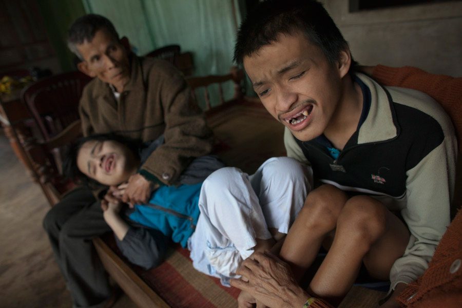 Brothers Nguyen Van Chuoi, 26 and Nguyen VanTrong, 22 are held by their father as they suffer the effects of Agent Orange more than 30 years after the war in Vietnam