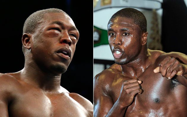 Andre Berto's demolished face after fighting Roberto Guerrero.