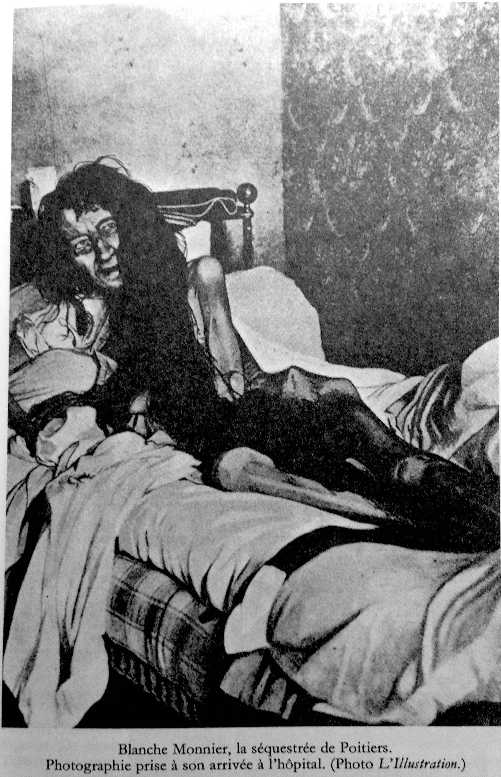 In 1901, in France, a woman was found in weak health after having been confined in a room during 24 years by her mother. This is a picture of when they freed her.
